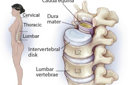 Lumbar Spine