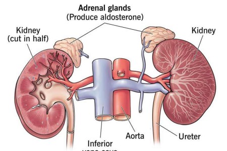 Hyperaldosteronism