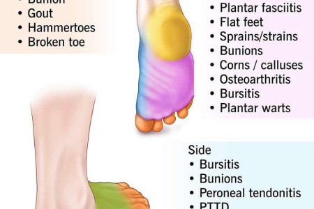 Foot Pain