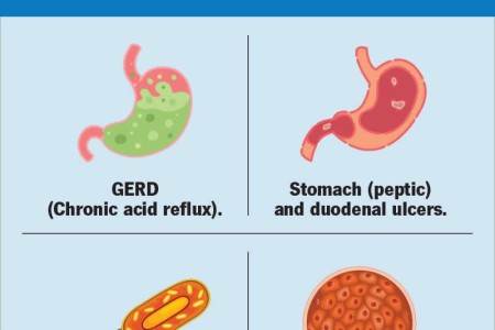 Proton Pump Inhibitors