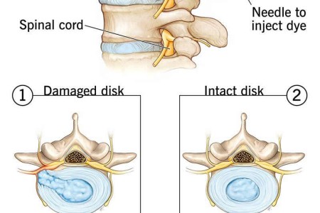 Discogram (Discography)