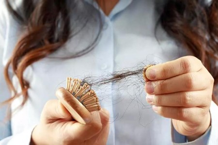 Is My Thyroid to Blame for My Hair Loss?