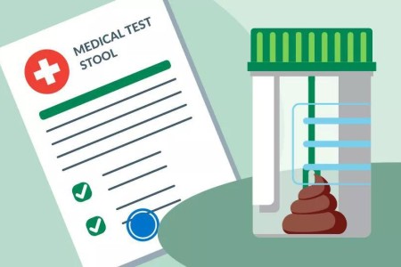 Is an At-Home Colon Cancer Test Worth Trying?