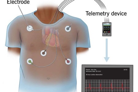 Cardiac Telemetry Monitoring