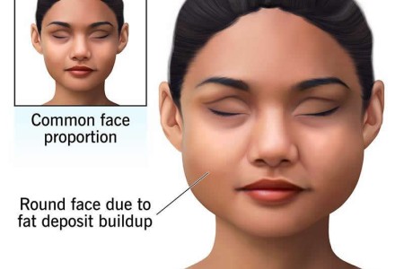 Moon Face - Moon Facies