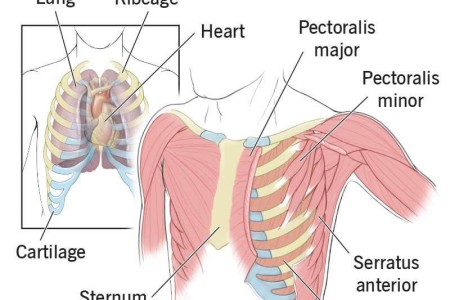 Musculoskeletal Chest Pain