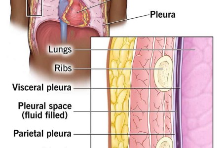 Pleura