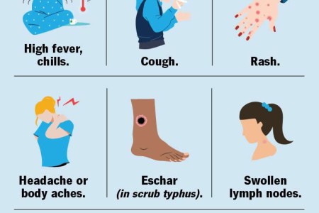 Typhus