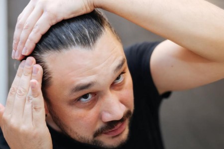 Does Creatine Cause Hair Loss?