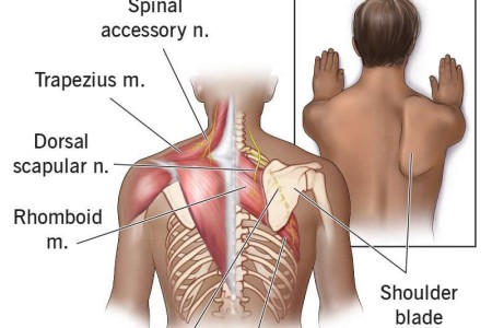 Winged Scapula