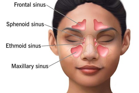 Paranasal Sinuses