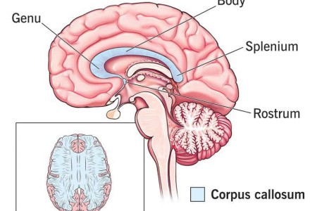 Corpus Callosum