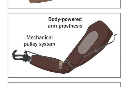 Prosthetic Arm