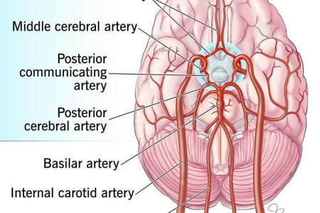 Circle of Willis