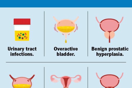 Urinary Urgency