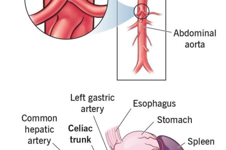 Celiac Trunk
