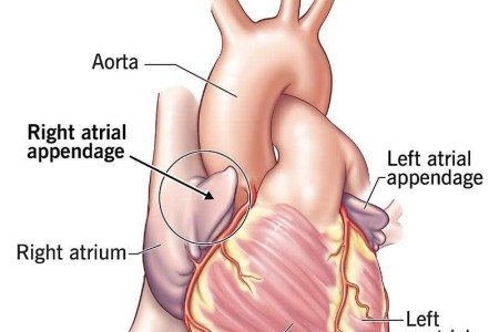 Right Atrial Appendage
