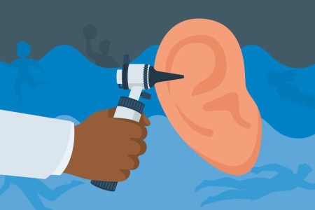 How To Steer Clear of Swimmer’s Ear