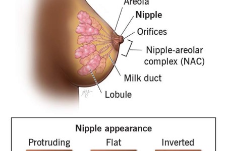 Nipple