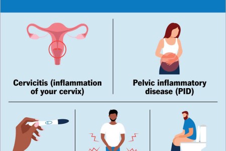 Mycoplasma Genitalium (Mgen)