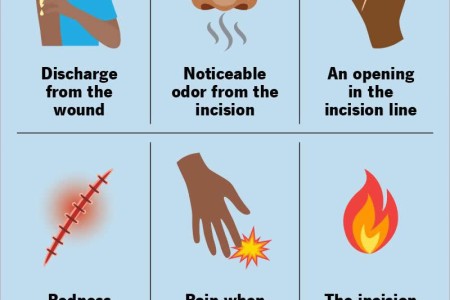 Surgical Wound Infection