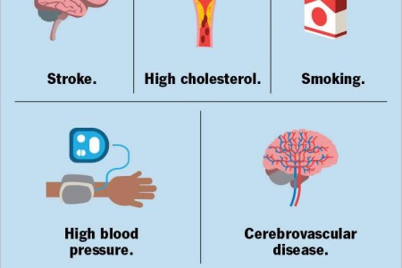 Vascular Parkinsonism