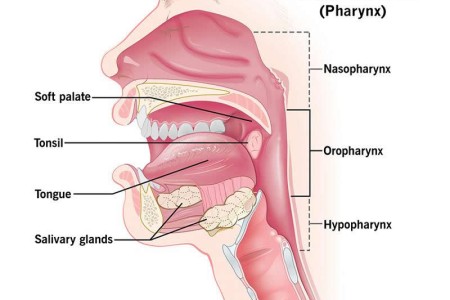 Oropharyngeal Cancer