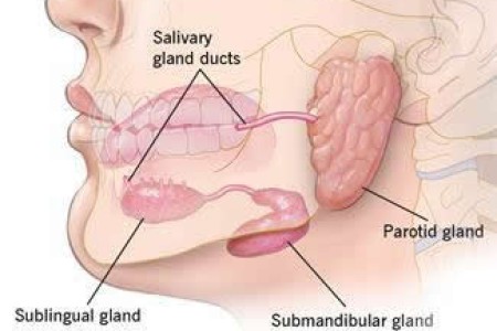 Sialadenitis