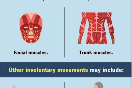 Tardive Dyskinesia
