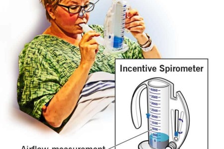 Incentive Spirometer