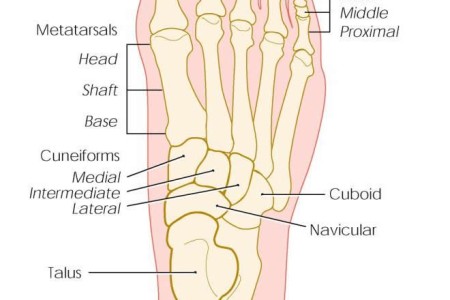 Stress Fractures