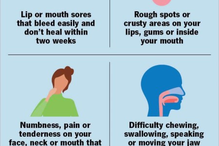 Oral Cancer