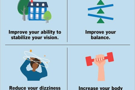 Vestibular Rehabilitation Therapy