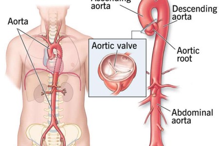 Aorta