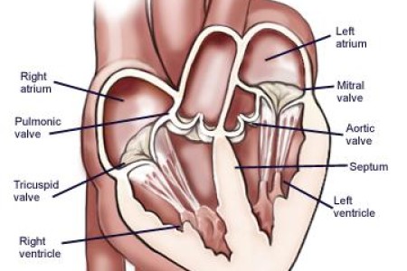 Heart Valves
