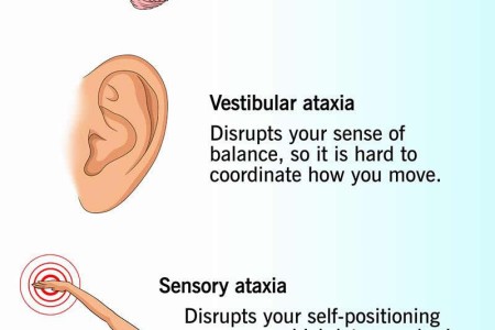 Ataxia