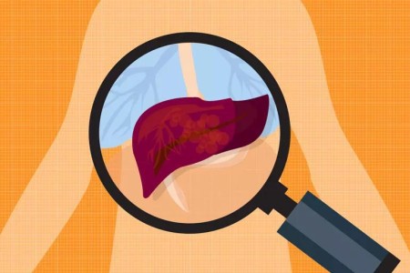 4 Signs Your Liver Is in Trouble + Tips to Protect It