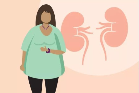 Obesity Increases Your Risk for Chronic Kidney Disease