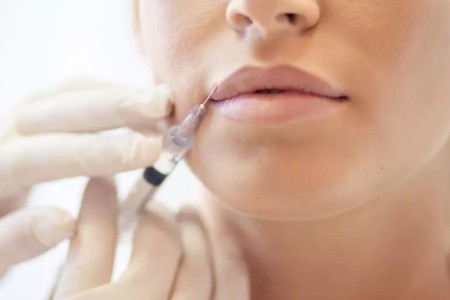 Can a Lip Filler Trigger a Cold Sore?