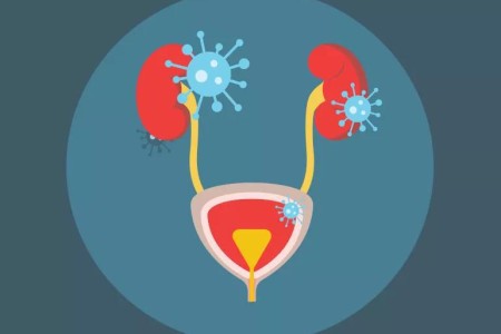 Urinary Tract Health, From Bladder to Kidney Infections