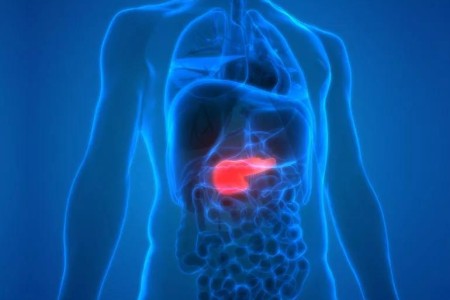Pancreatic Cancer: It’s on the Rise, But There’s Reason to Be Hopeful