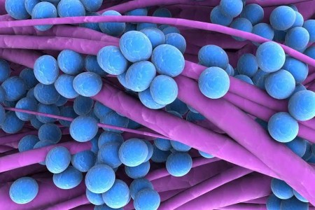 What Causes Staph Infections, and How Can You Avoid Them?