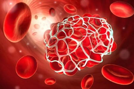 Why Vitamin K Can Be Dangerous If You Take Warfarin