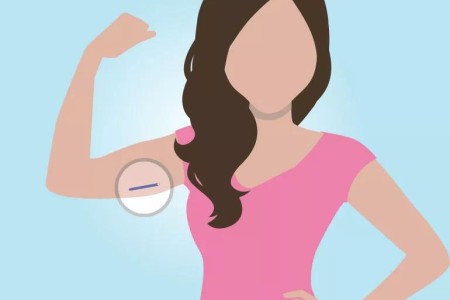 Is a Birth Control Implant Right for You?