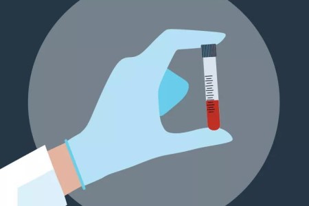 When Should I Start Having My Cholesterol Checked? (Hint: Probably Sooner Than Y