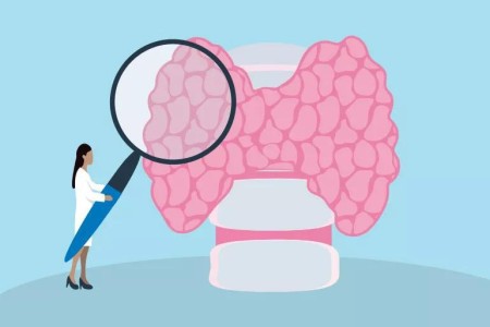 Thyroid Disease May Run in Your Family — and You Might Not Know It