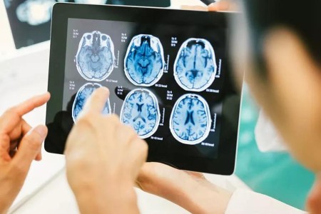 Suspect a Concussion? How to Help (Not Hurt) Your Recovery