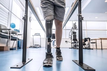 5 Ways to Deal With Phantom Limb Pain After Amputation