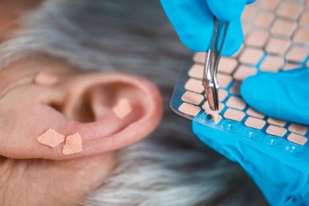 Want to Quit Smoking? Acupuncture Can Help You With Cravings