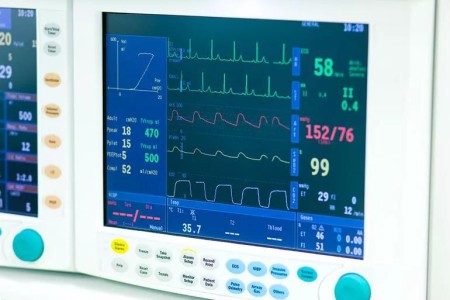 Why You May Not Need a Stress Test
